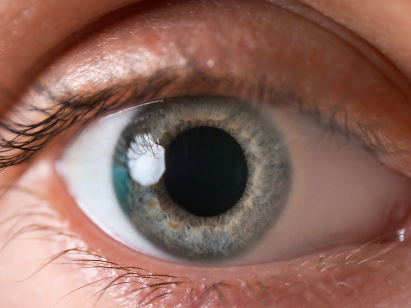 ▷ Pupilas Dilatadas | Causas ¿De qué son Síntoma?