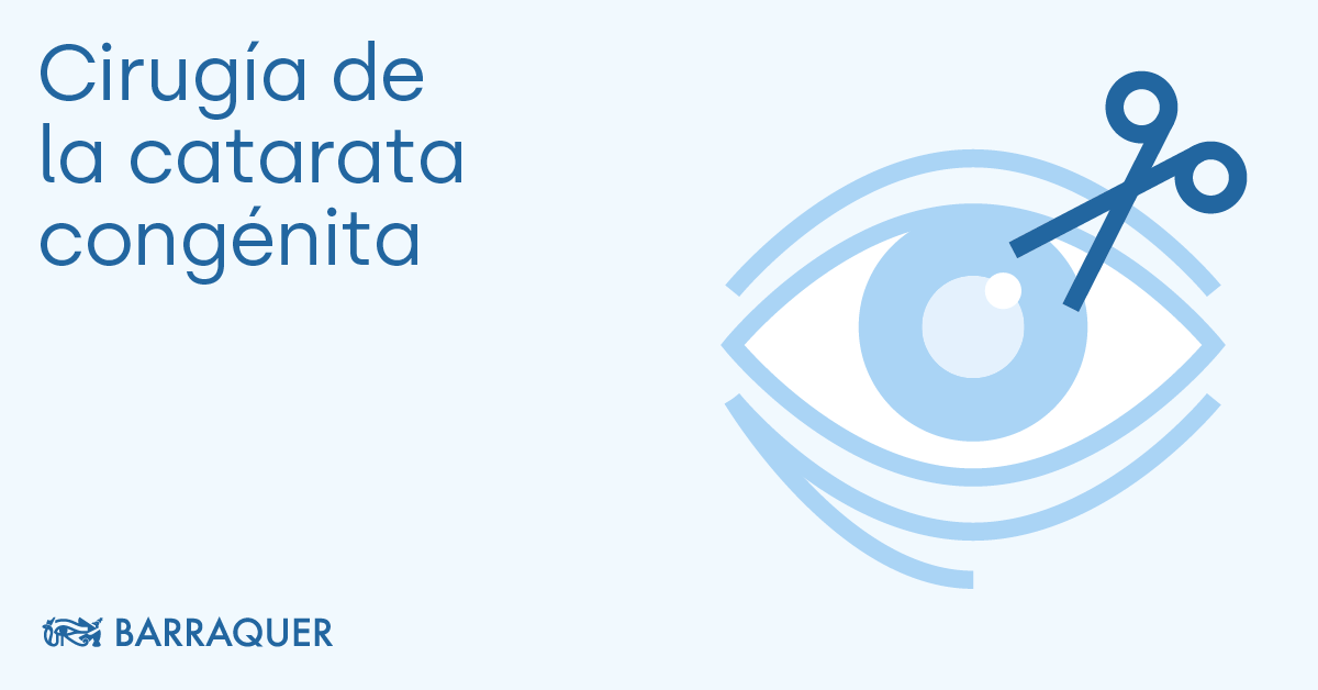 Chirurgie De La Cataracte Congenitale Infantile Barraquer