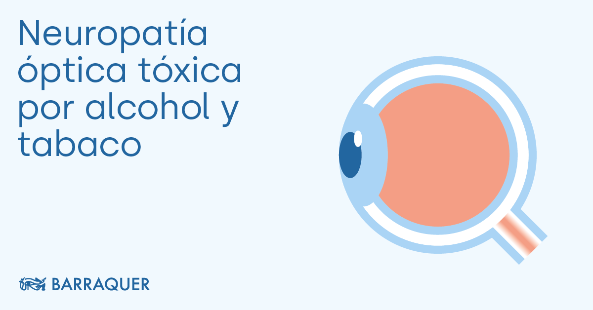 tobacco alcohol optic neuropathy Alcohol and tobacco abuse-related optic neuropathy