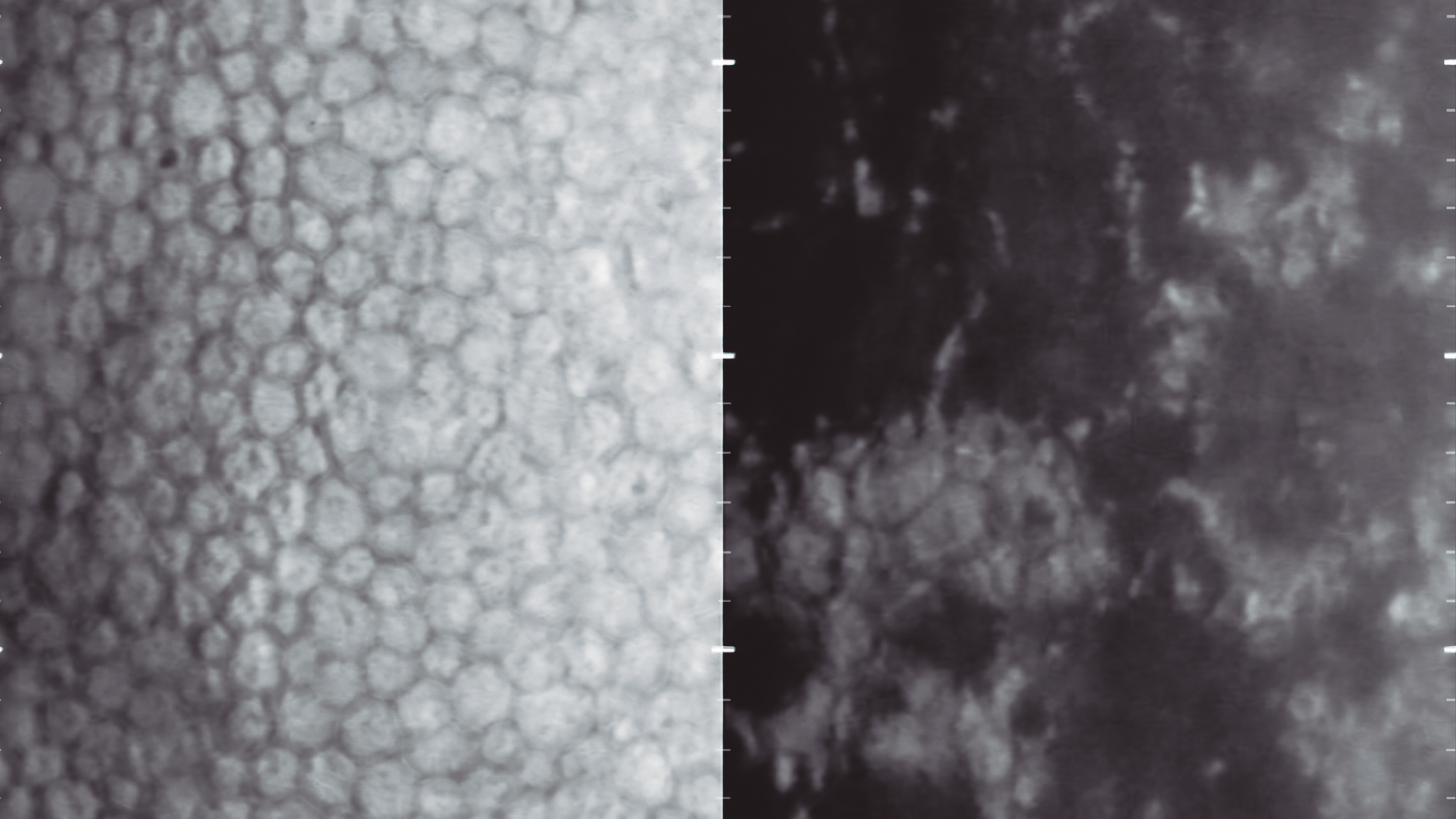Microscòpia especular