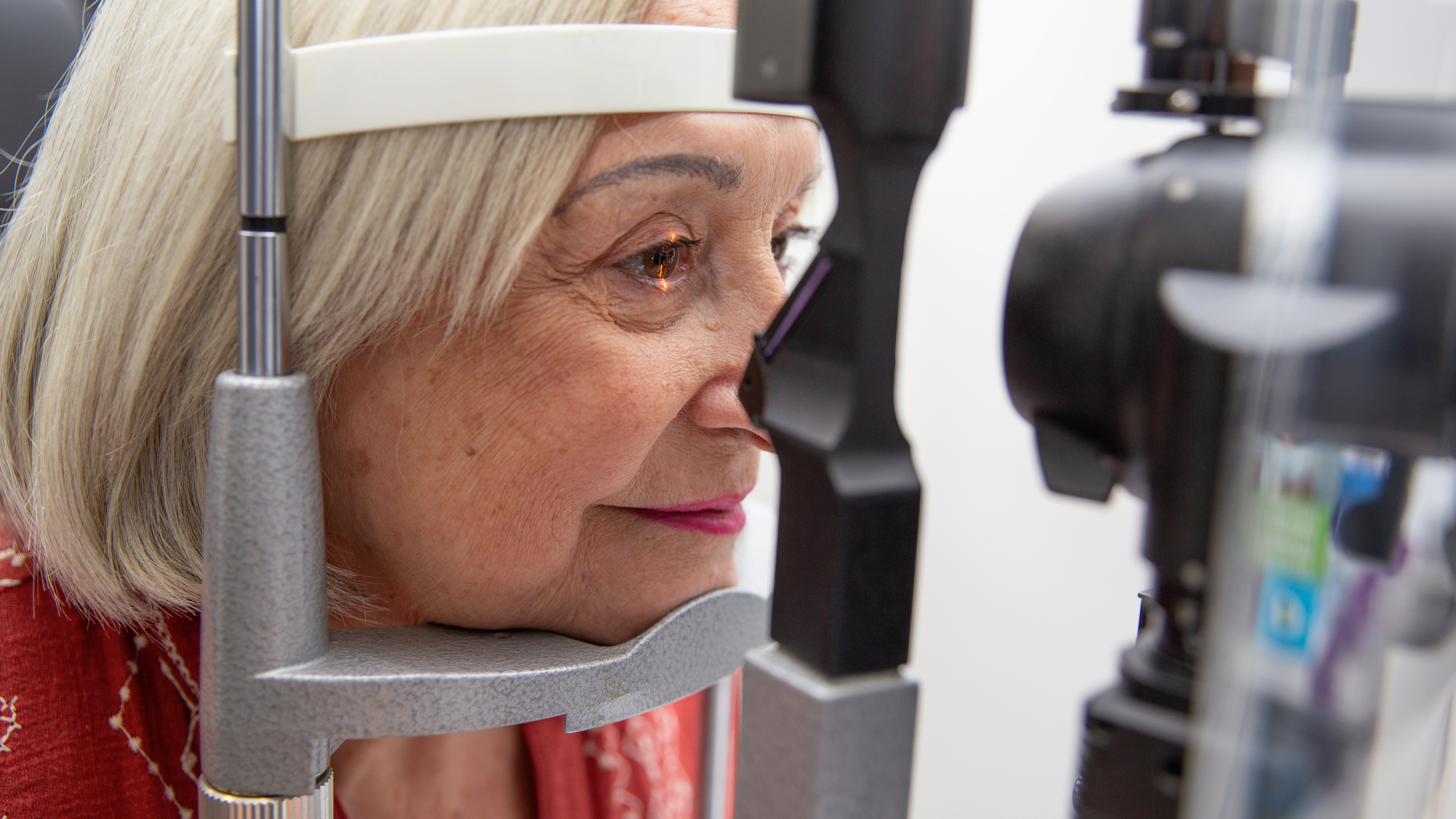 Col·liris glaucoma